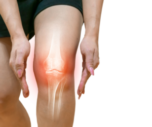 Ask the Expert: Physical therapy before joint replacement surgery
